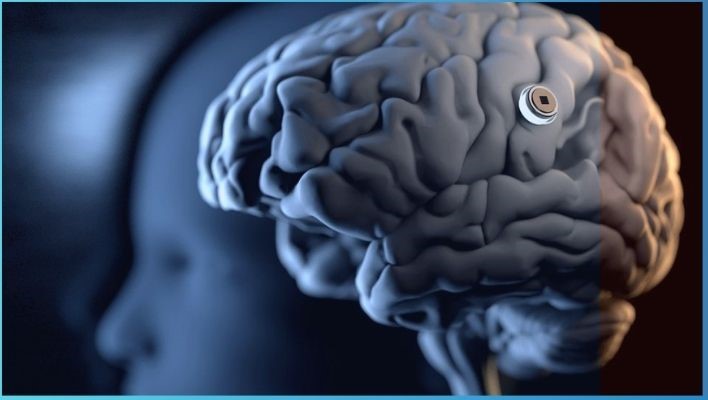 8 Key facts about Neuralink - What does Elon Musk Neuralink brain chip actually do? Challenges and Limitations of Neuralink