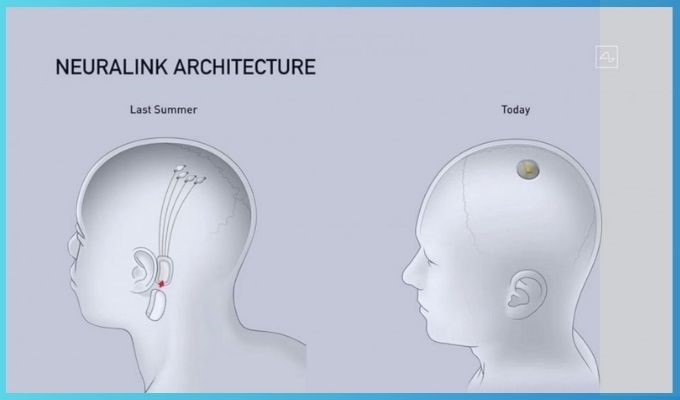 8 Key facts about Neuralink - What does Elon Musk Neuralink brain chip actually do? Integration of Neuralink's Brain Chip